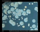 P.aeruginosa, E.faecalis, S.aureus
